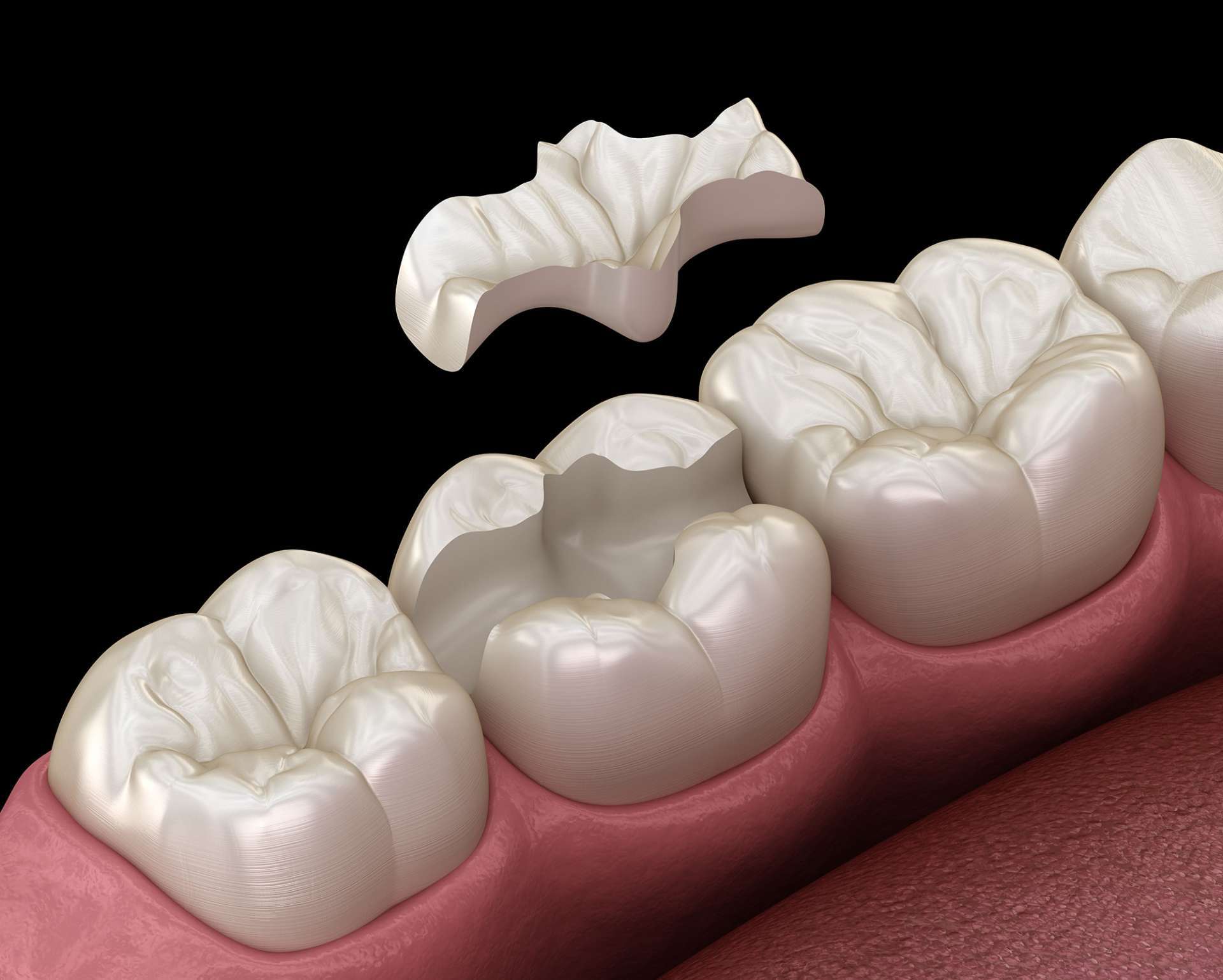 Vratite osmijeh uz Dental centar Ivić Peharda
